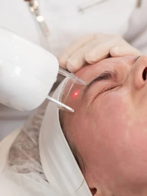 laser-services-b-at-micari-aesthetic-wellness